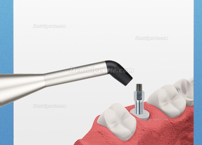 WJ Implant Stability Quotient Messger&auml;t Implant Stability-Messger&auml;t (Upgraded)
